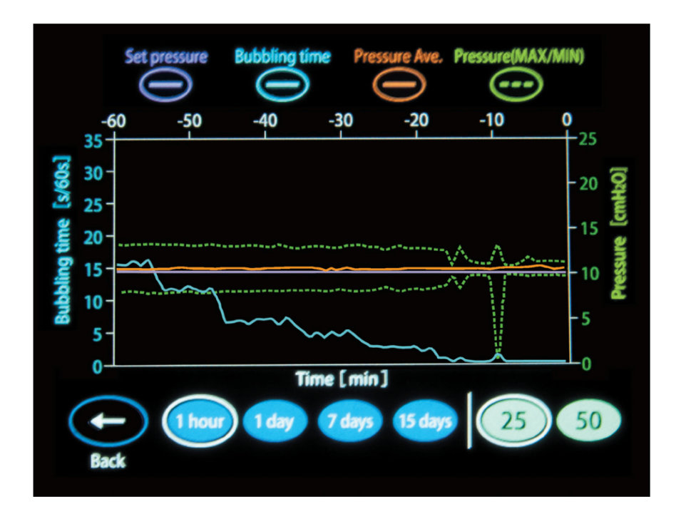 Trend 그래프 화면